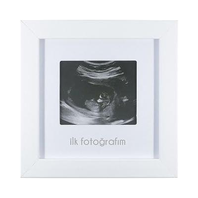 FUFİZU İlk Fotoğrafım Bebek Ultrason Çerçevesi - Bebek Odası Resim Anı Çerçevesi