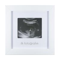 FUFİZU İlk Fotoğrafım Bebek Ultrason Çerçevesi - Bebek Odası Resim Anı Çerçevesi